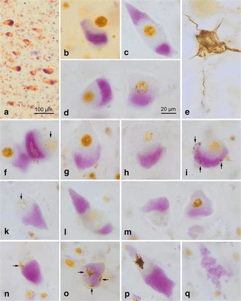 Betz cells .